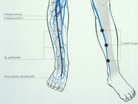 Diep en oppervlakkig systeem