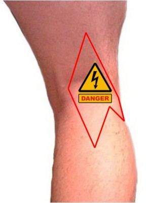 Anatomie van het been