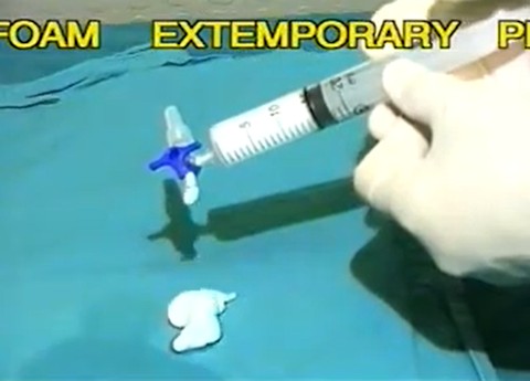 Video foam scleroseren