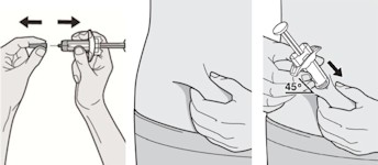 Dupixent (dupilumab)