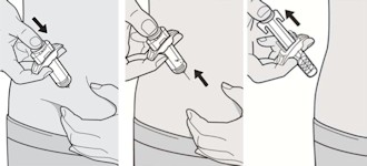 Dupixent (dupilumab)