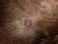 CDLE van het behaarde hoofd