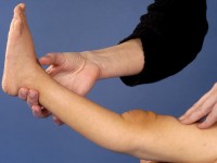 Ehlers-Danlos syndroom