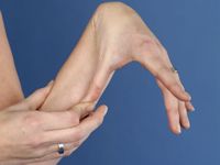 Ehlers-Danlos syndroom