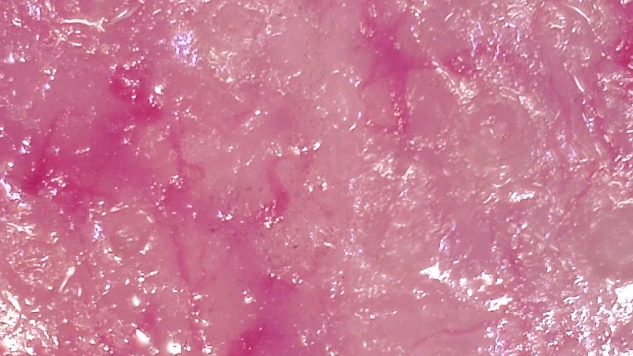 bloed, erytrocyten stromend door capillairen in de epidermis