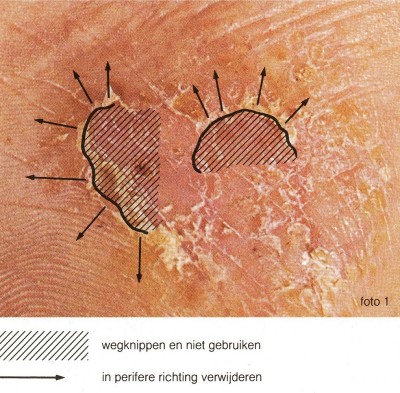 Het maken van een KOH preparaat