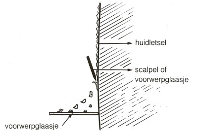 Het maken van een KOH preparaat