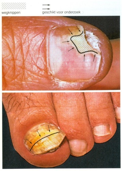 Het maken van een KOH preparaat