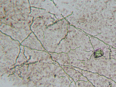 Hyphen in KOH-preparaat