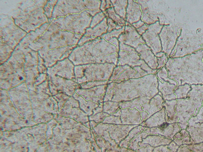 Hyphen in KOH-preparaat