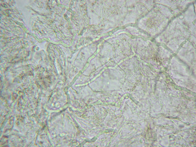 Hyphen in KOH-preparaat