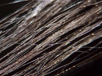 Piedra alba, white piedra, schimmelinfectie haren