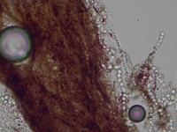 Tinea capitis door een ectothrix groeiwijze Trichophyton verrucosum