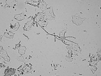 Trichophyton verrucosum