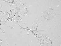 Trichophyton verrucosum