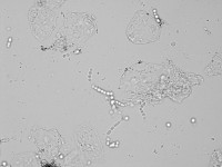 Trichophyton verrucosum