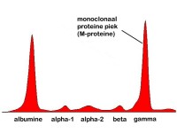 Eiwitspectrum met abnormale piek van M-proteinen