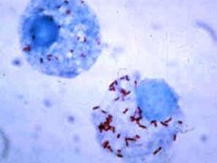 Rickettsia rickettsii