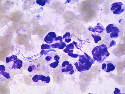 Haemophilus ducreyi (Giemsa-preparaat)