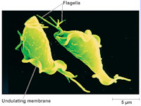 Trichomonas vaginalis, trichomoniasis