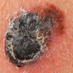 ABCD rule: asymmetry