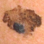 ABCD rule: asymmetry