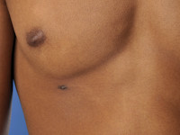 Accessoire (extra) tepel