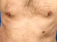 Accessoire (extra) tepel