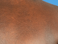 Atopisch eczeem bij donkere huid, folliculair eczeem