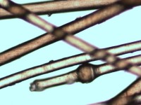 Trichorrhexis invaginata (bamboo hairs)