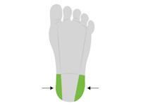 Calcinosis cutis na hielprik