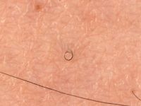 Circle hairs
