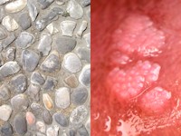 Cobblestone oppervlak