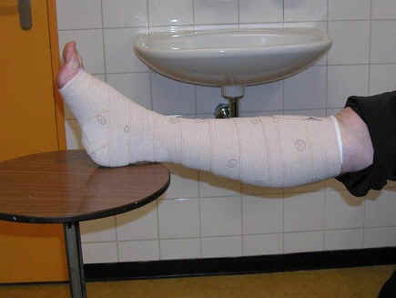 Proguide 2-laags elastisch compressieverband