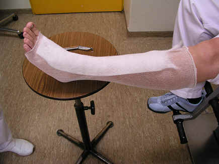 Niet-elastisch compressieverband