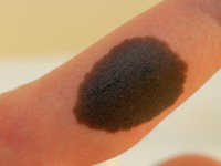 Congenitale melanocytaire naevus