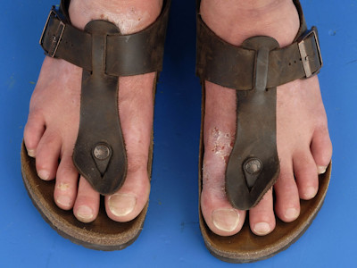 Chroom allergie leren schoenen