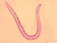 Creeping eruption (larva cutanea migrans) door Ancylostoma braziliensis