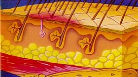 Graad 1 decubitus (niet wegdrukbaar erytheem)
