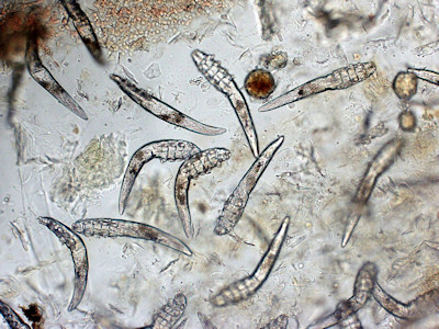 Demodex folliculorum
