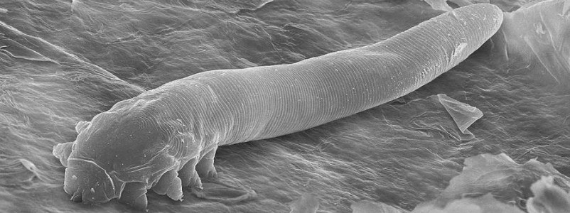 Demodex folliculorum