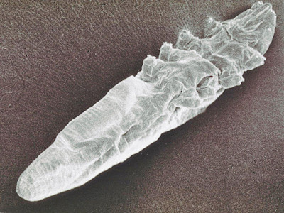 Demodex folliculorum