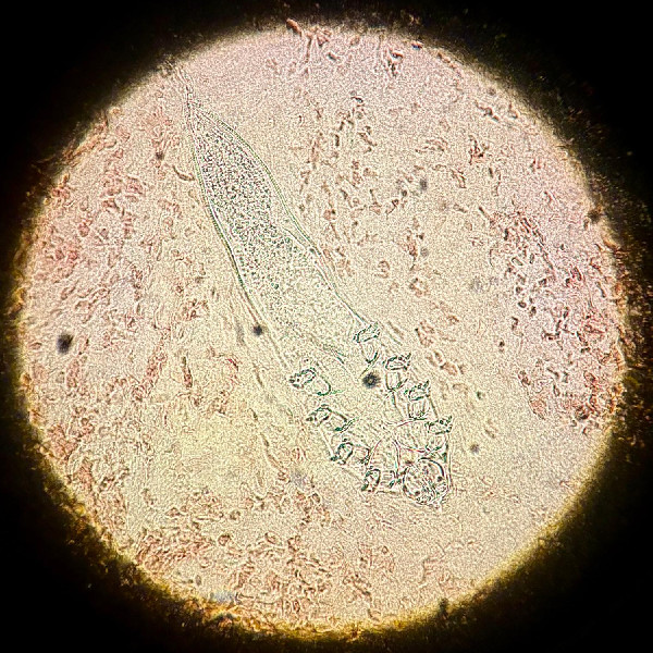 Demodex mijt