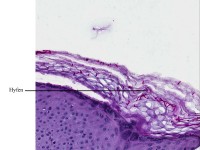 Dermatomycose, PAS kleuring