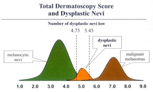 Dermatoscopie score beoordelen