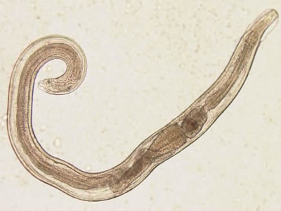 Enterobius vermicularis