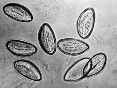 Enterobius vermicularis