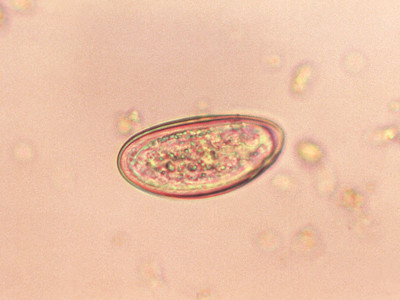 Enterobius vermicularis