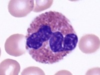 Eosinofiele granulocyt