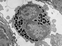 Eosinofiele granulocyt